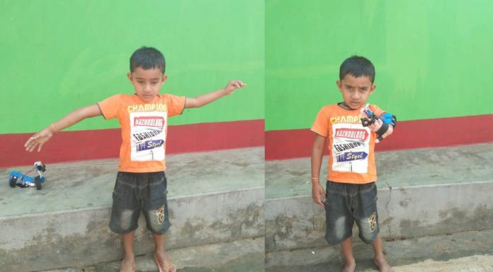 हेमीप्लेजिया से ग्रसित नन्हें निकेश के हाथों में फिर आई जान