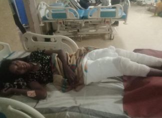 मुख्यमंत्री की संवेदनशीलता से आग से झुलसी सुकान्तिबाई के पैरों की सफल सर्जरी हुई